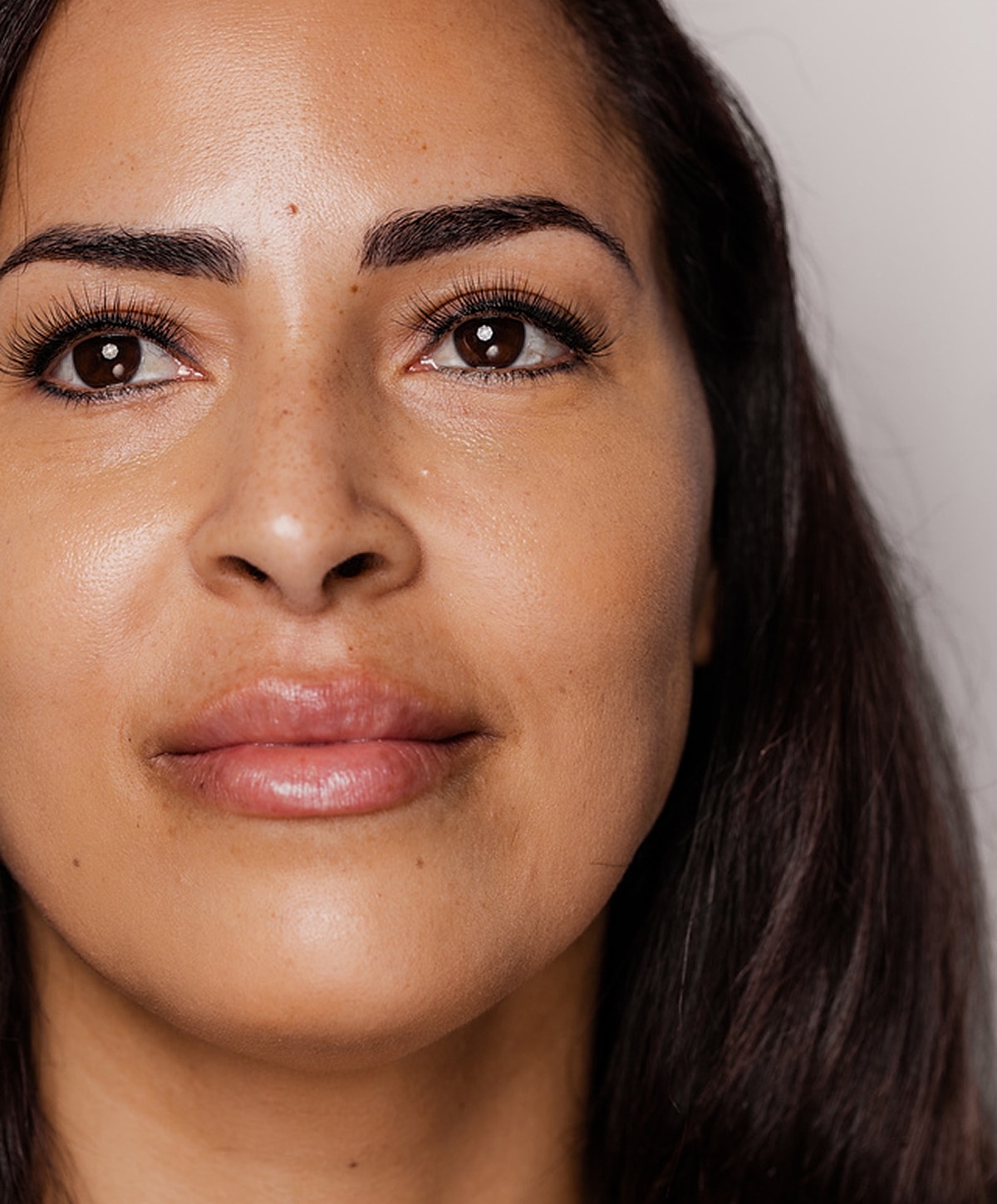 Newport Beach Laser Skin Resurfacing model with brown eyes.