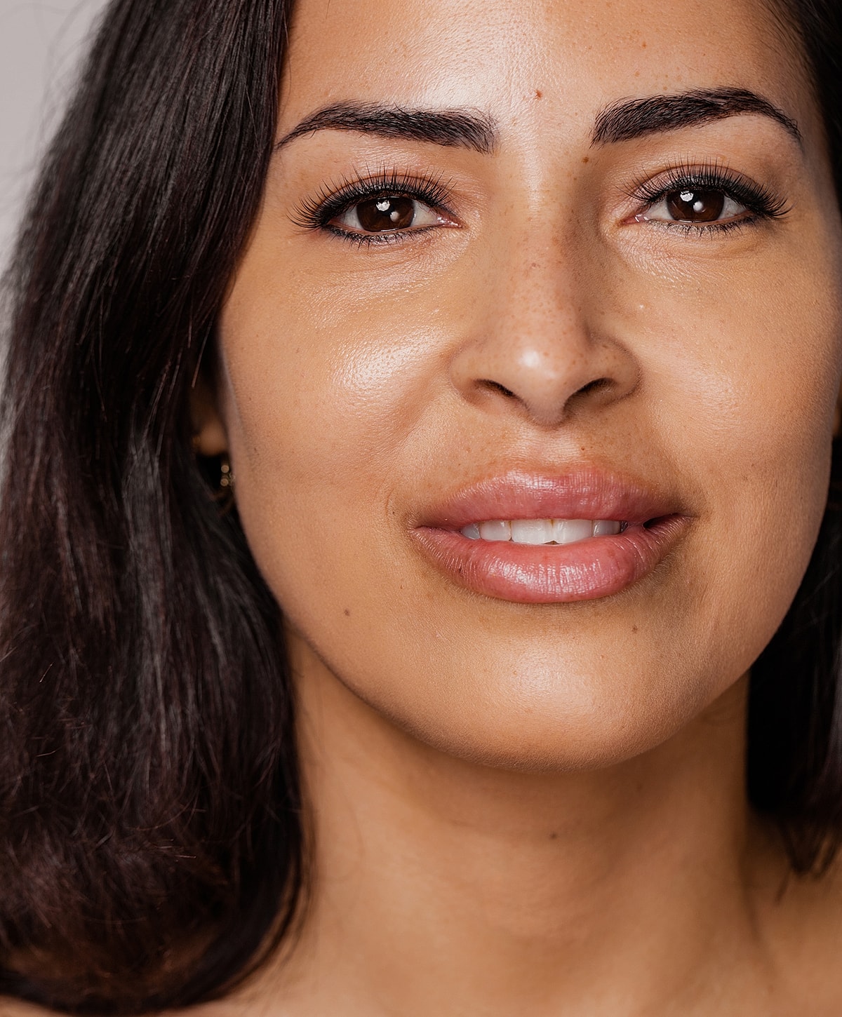 Rancho Santa Margarita Genesis Laser Skin Therapy model smiling.